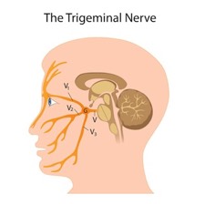 Irritation of the Trigeminal Nerve Causes Trigeminal Neuralgia